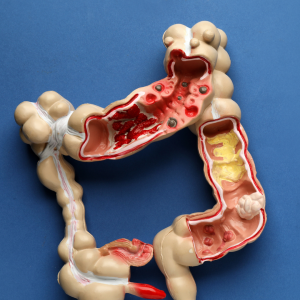 gastroenterologia en charallave